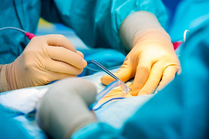 In Surgery, Electrosurgery Is Often Used To Control Bleeding And Rapidly Dissect Soft Tissue